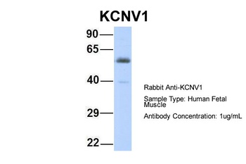 KCNV1 Antibody