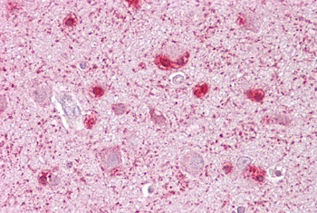 MCM3 Antibody
