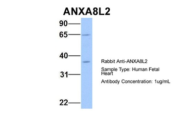 ANXA8L2 Antibody