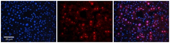 RAD54B Antibody