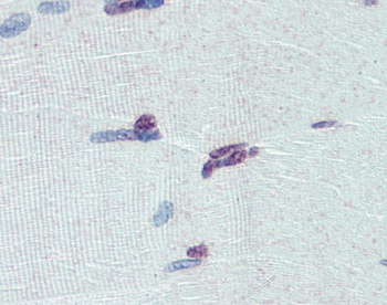 PRDM9 Antibody