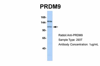 PRDM9 Antibody