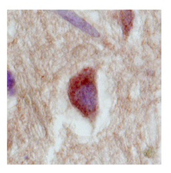 SLC18A1 Antibody