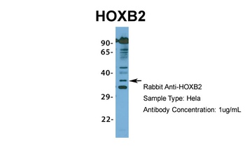 HOXB2 Antibody