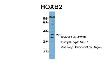 HOXB2 Antibody
