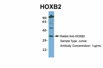 HOXB2 Antibody