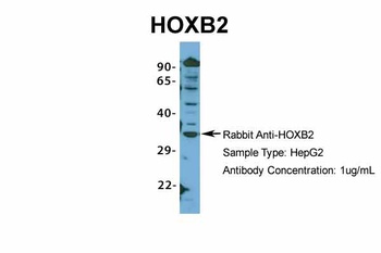 HOXB2 Antibody