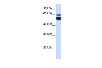 SMPD1 Antibody