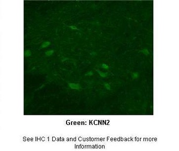 KCNN2 Antibody