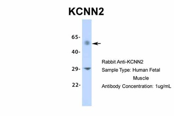 KCNN2 Antibody