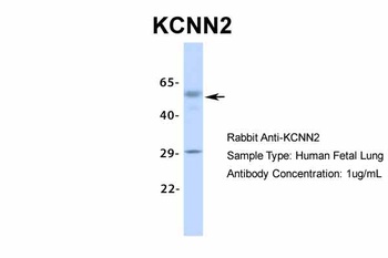 KCNN2 Antibody