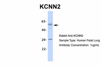 KCNN2 Antibody