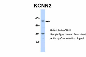 KCNN2 Antibody