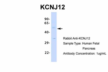 KCNJ12 Antibody