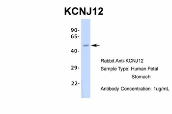 KCNJ12 Antibody