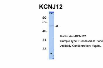 KCNJ12 Antibody