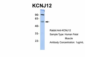 KCNJ12 Antibody