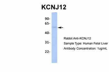 KCNJ12 Antibody