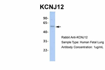 KCNJ12 Antibody