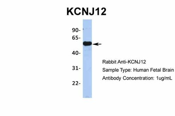 KCNJ12 Antibody