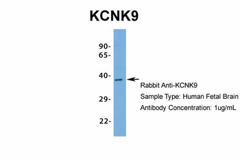 KCNK9 Antibody