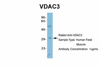 VDAC3 Antibody