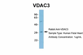 VDAC3 Antibody