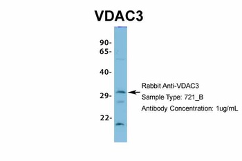 VDAC3 Antibody