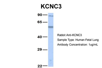 KCNC3 Antibody