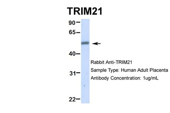TRIM21 Antibody