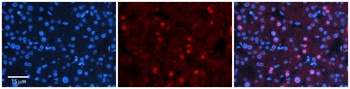 ZNF236 Antibody