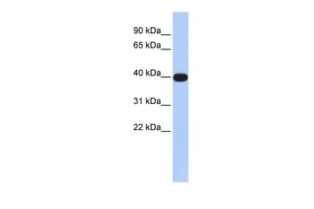 LMX1A Antibody