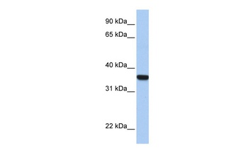 HOXD1 Antibody