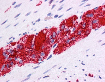 NR2E1 Antibody