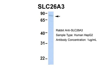 SLC26A3 Antibody