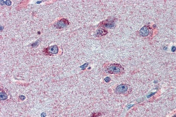 TSPAN8 Antibody
