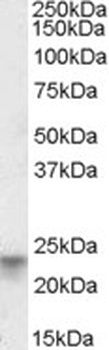 F2R Antibody