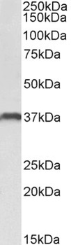 VPS16 Antibody