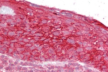 Exosome Component 9 Antibody
