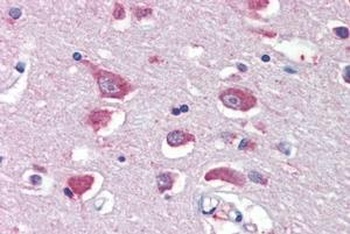 OAZ Antibody