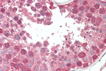 EBF1 Antibody
