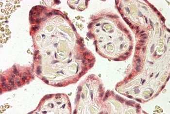 FHL3 Antibody