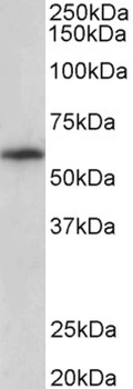 TRC8 Antibody
