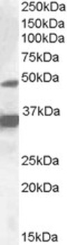 EWSR1 Antibody