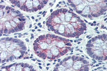 EWSR1 Antibody