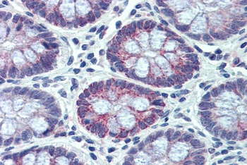 EWS Antibody