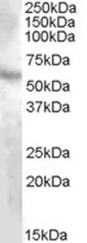 TMPRSS4 Antibody
