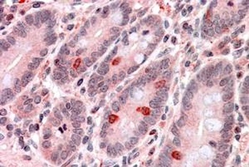 TMPRSS2 Antibody