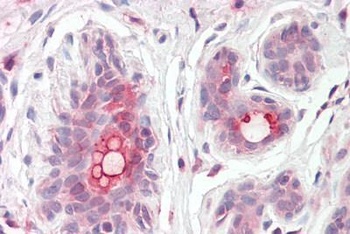 Trichohyalin-like 1 Antibody