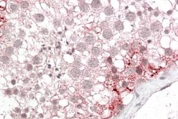 RETNLB Antibody